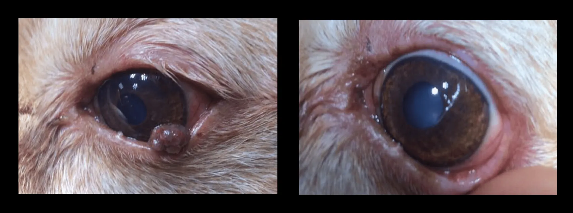 Cryosurgery