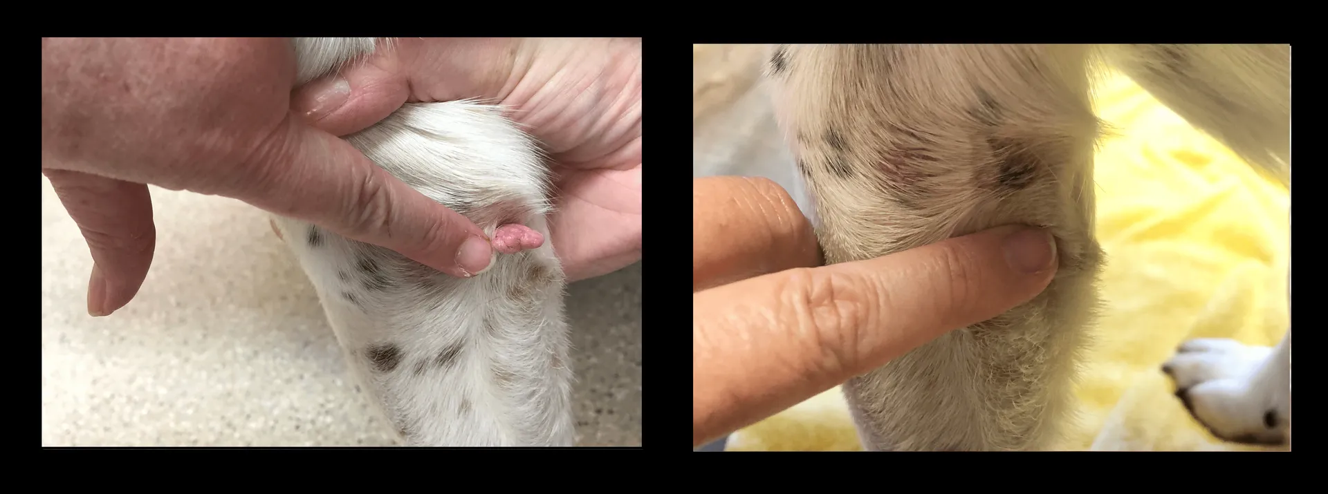 Cryosurgery