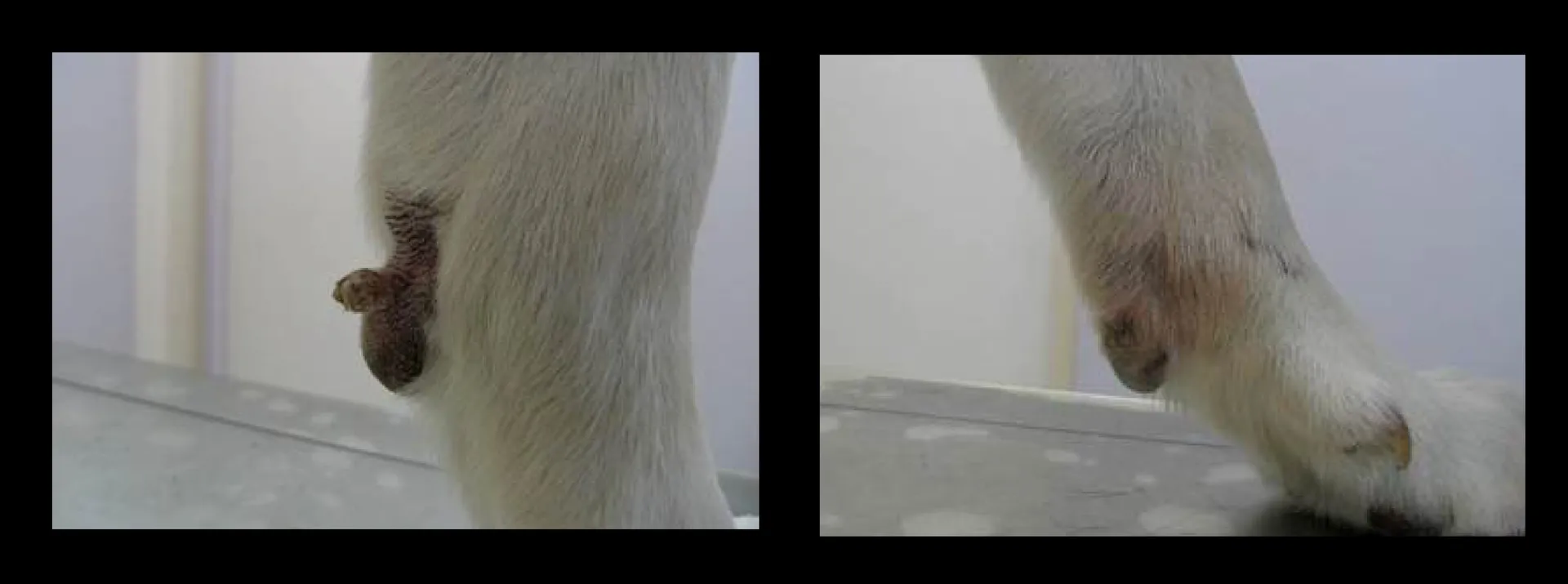 Cryosurgery